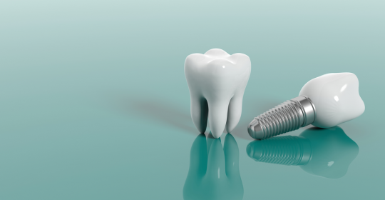 Dental Implants: Five Myths Busted For Good